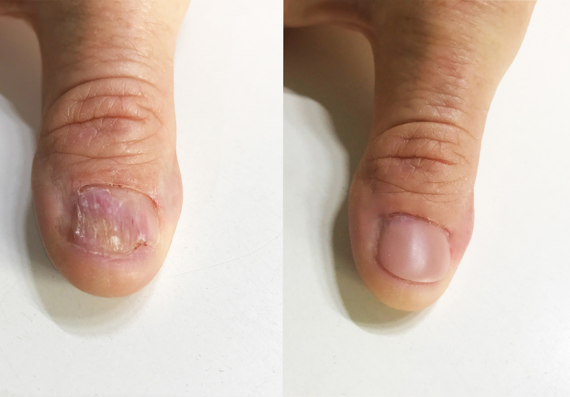 Nageldesign  eine reine Frauendomne? - Gut fr dich